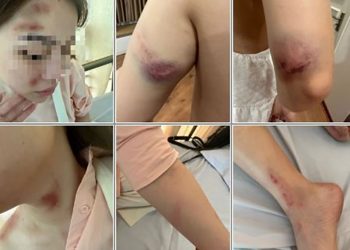 Hải Phòng: Một cán bộ công an quận bị tố đánh đập bạn gái dã man
