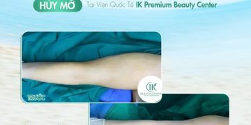 Review cơ sở Bệnh Viện IK Premium